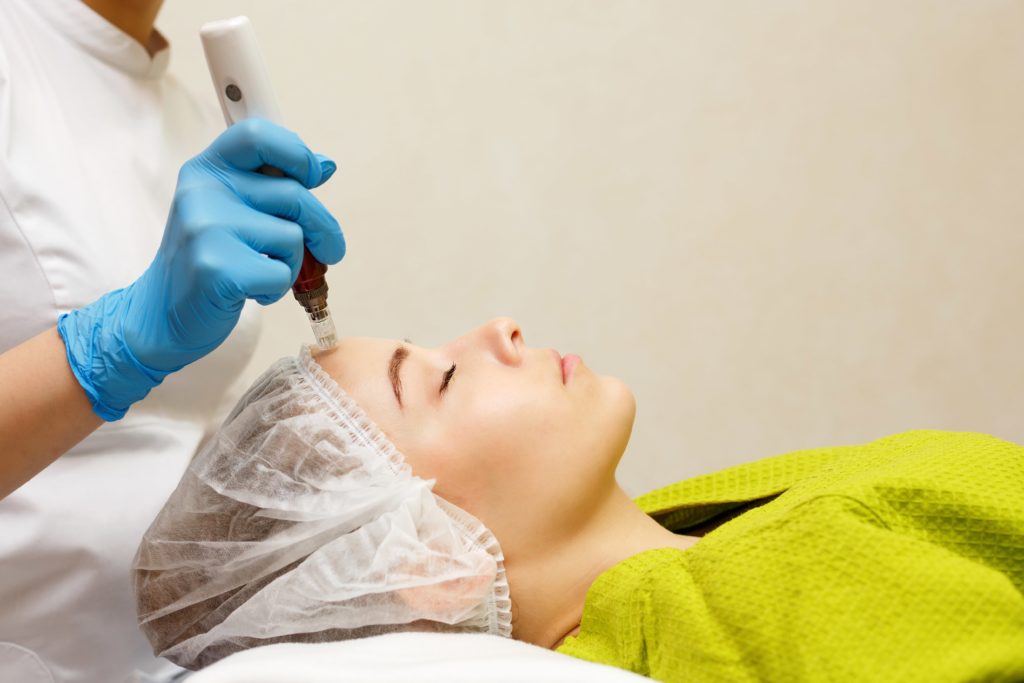 Microneedling Doncaster